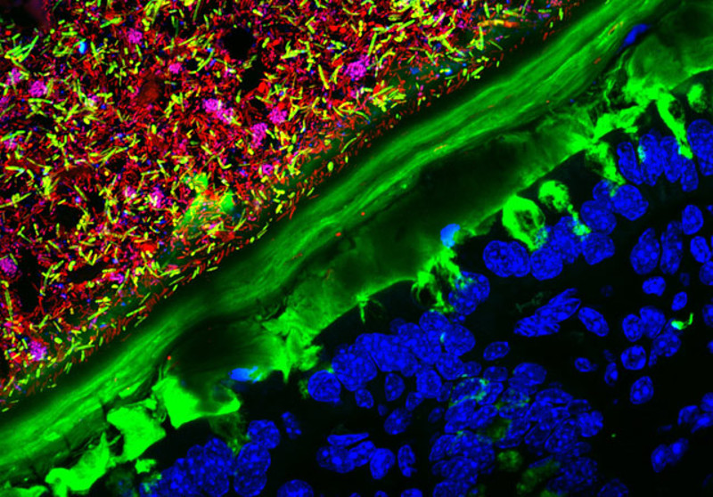Illustration for article titled These Are the Best Microscopic Images of 2015